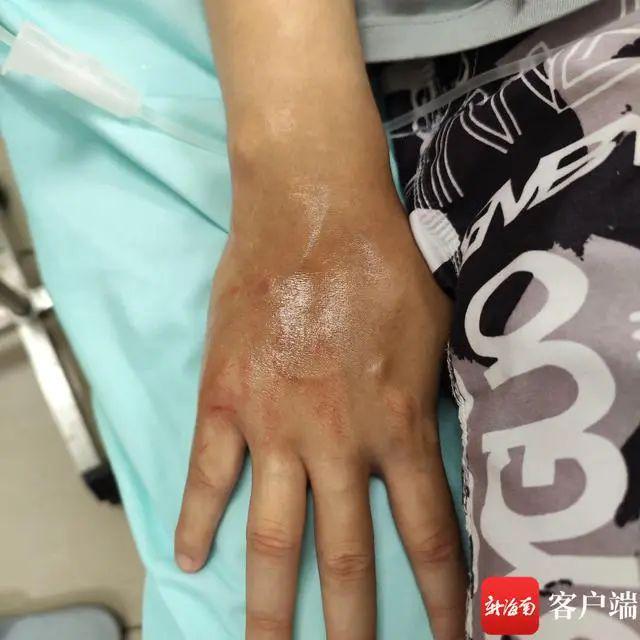 紧急提醒！广州人看到立即远离千万别碰这种“塑料袋”！(图3)