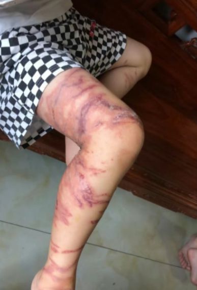 紧急提醒！广州人看到立即远离千万别碰这种“塑料袋”！(图4)