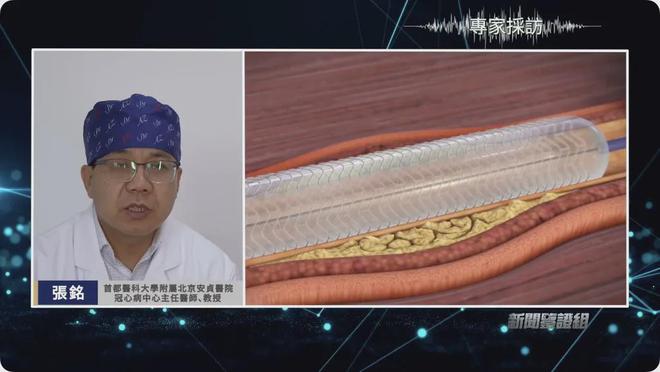 鉴证｜我们每天吃的塑料比饭都多？两小时入脑？顶级研究人员揭秘(图17)