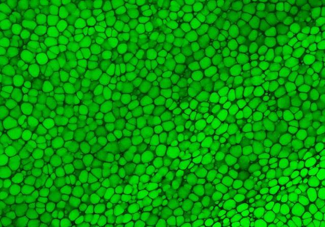 科学家发现一种骨骼组织类型 超级稳定、柔软、富有弹性
