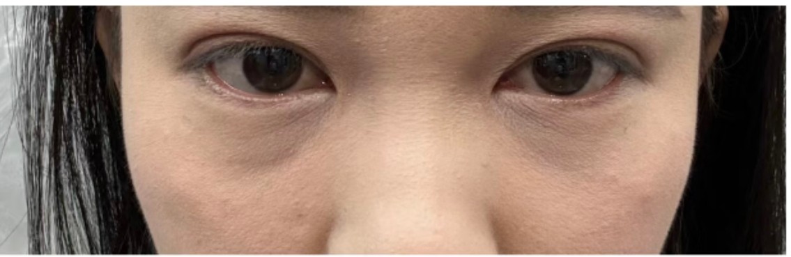 厦门海峡医疗美容多次被投诉消费者反映效果与宣传不符(图3)